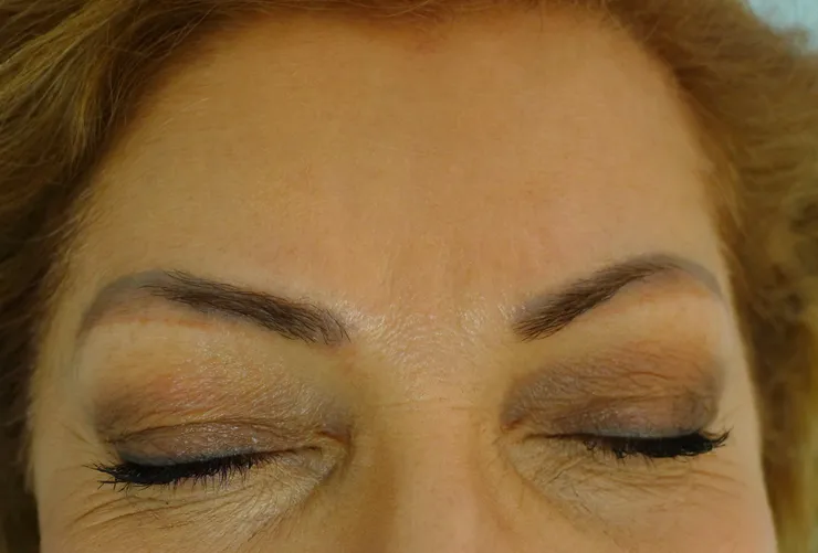 After correction, client 1