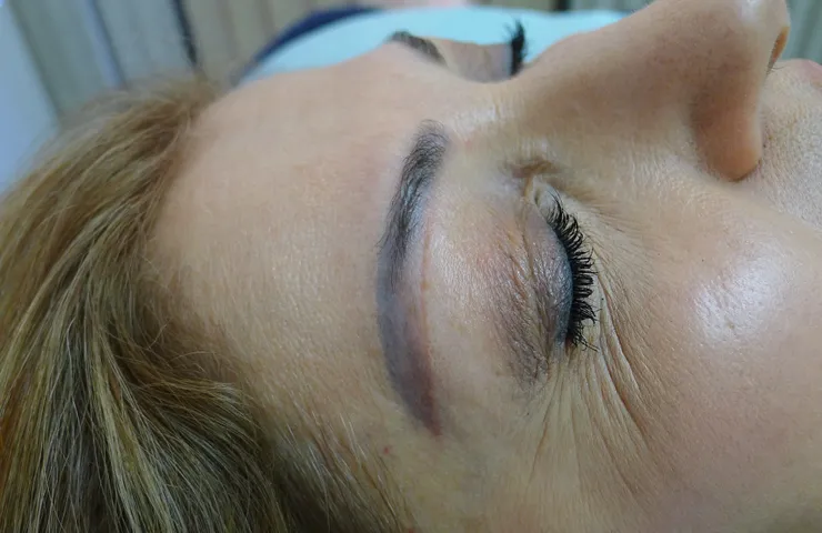 After correction, client 2