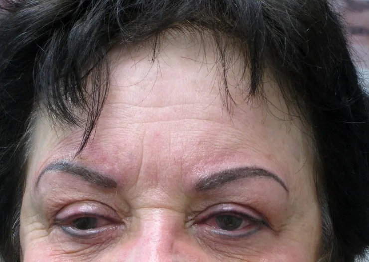 After correction, client 3