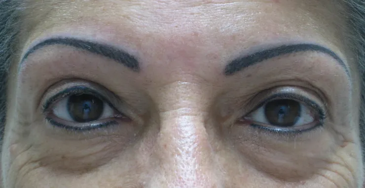 After correction, client 5