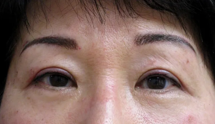 After correction, client 7