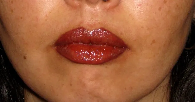 After correction, client 9