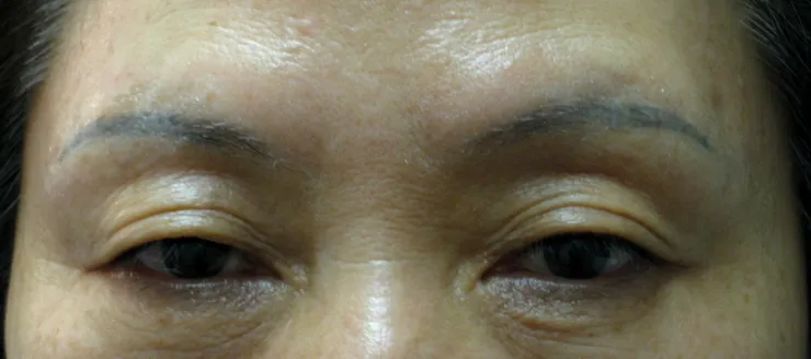 Before correction, client 10