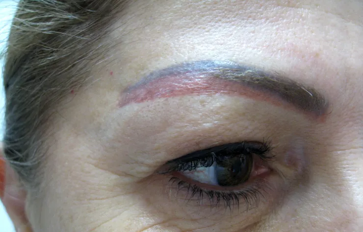 Before correction, client 2