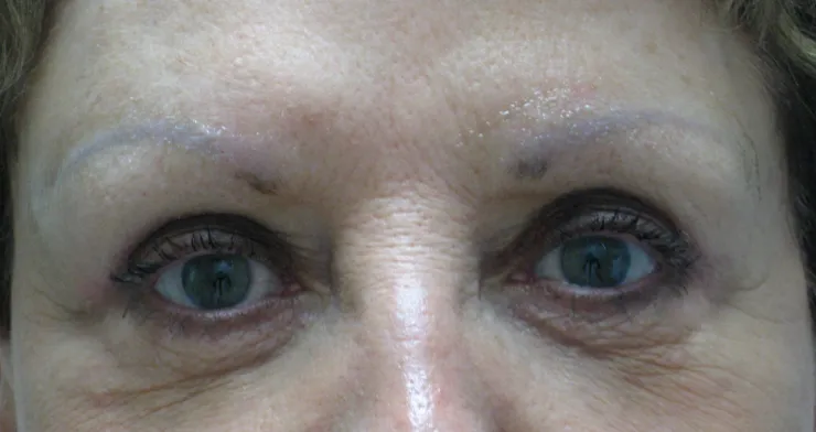 Before correction, client 4