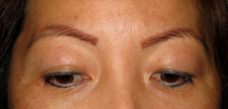 Before correction, client 6