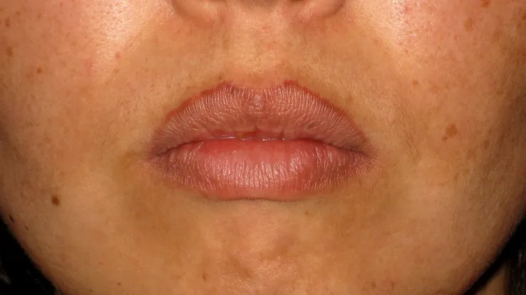 Before correction, client 9